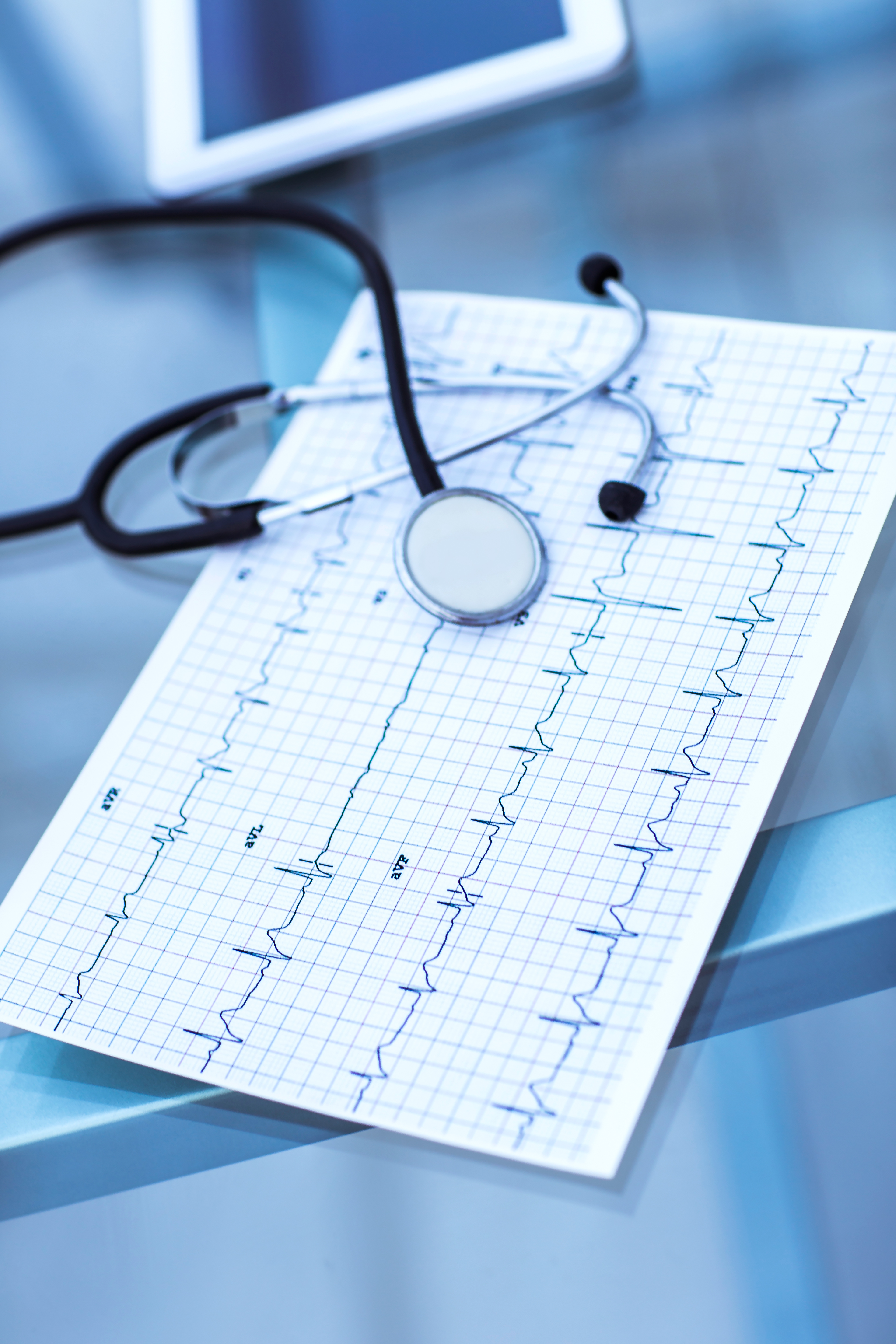Eletrocardiograma