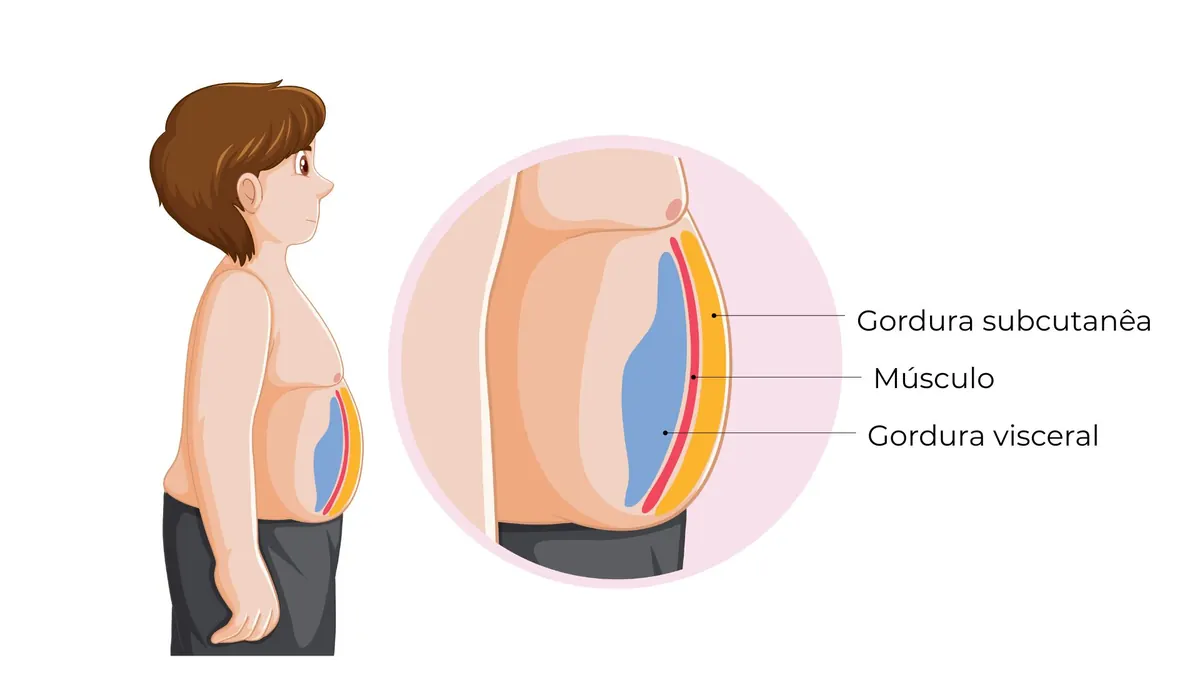 ilustração de gordura visceral